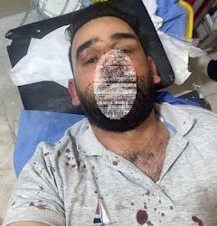 اعلامي عراقي يتعرض الى إعتداء وحشي من قبل مجهولين في كوفة النجف